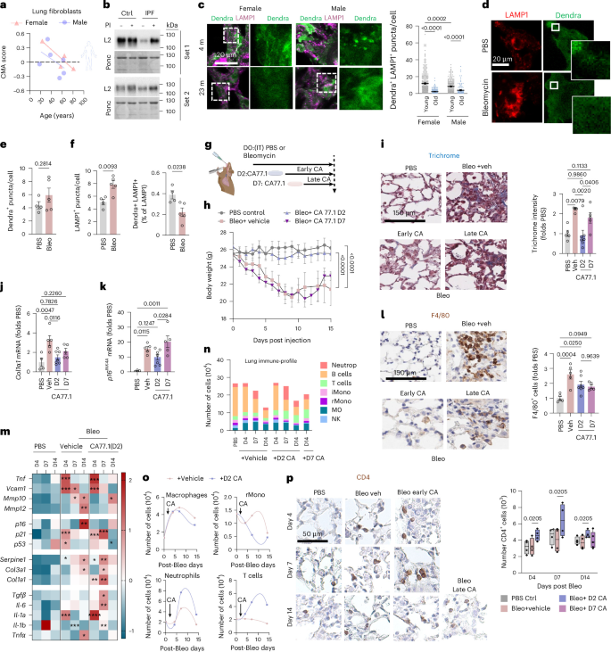 Fig. 7: Pharmacological activation of CMA ameliorates lung fibrosis.