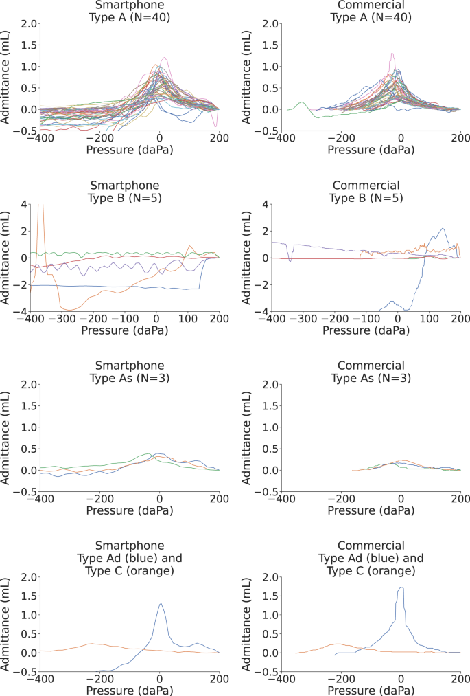 A diagram for plotting findings for tympanometry and acoustic