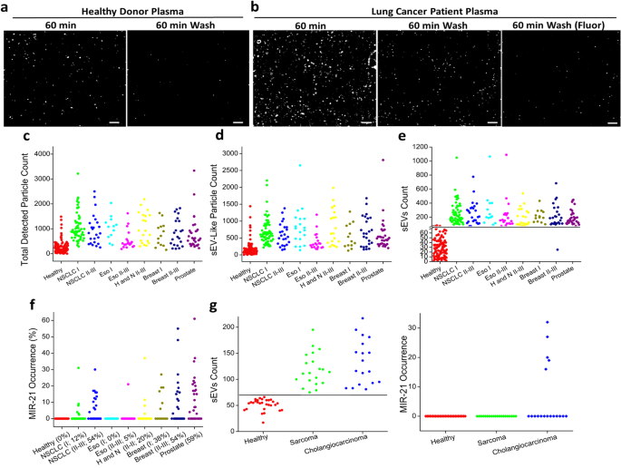 Fig. 4: Profiling plasma sEVs from healthy donors and cancer patients.