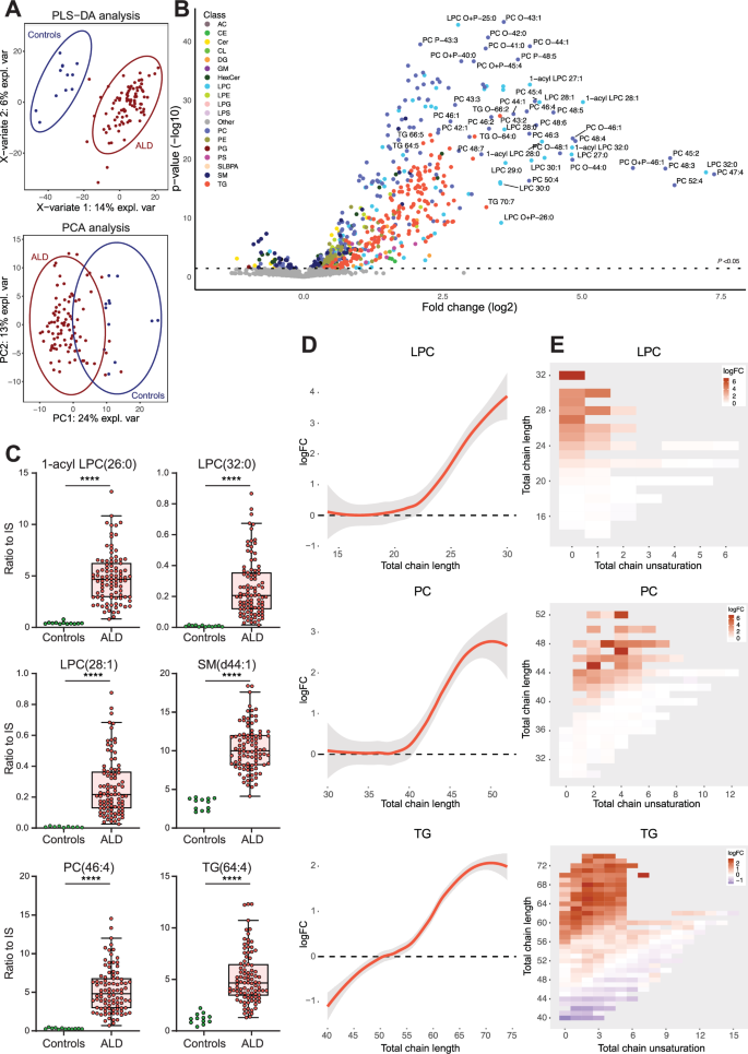 Lipidomic biomarkers in plasma correlate with disease severity in adrenoleukodystrophy | Communications Medicine lipidomic-biomarkers-in-plasma-correlate-with-disease-severity-in-adrenoleukodystrophy-communications-medicine