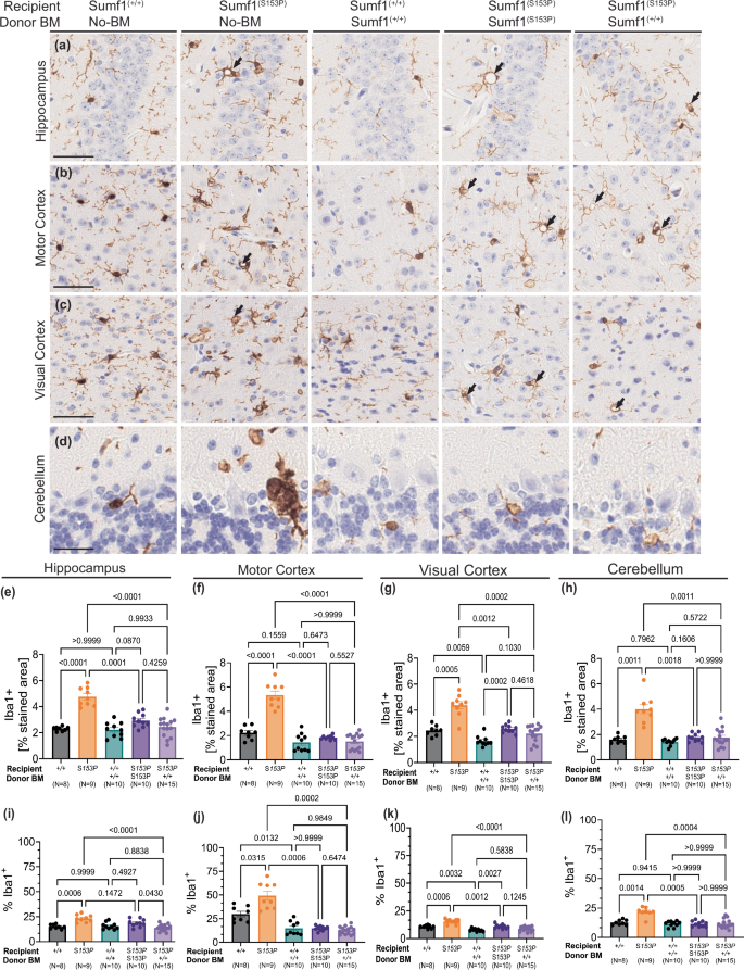 Fig. 4: Persistent microgliosis after HSCT.