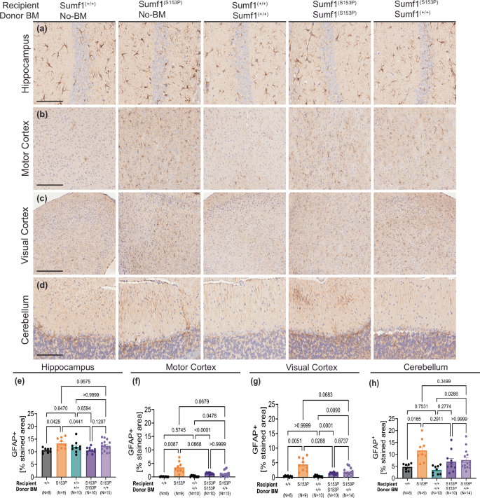 Fig. 5: HSCT was not able to ameliorate Astrocytosis.