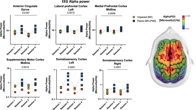 Fig. 2: Phrenic nerve increases EEG alpha frequency in deeply sedated mechanically ventilated patients.