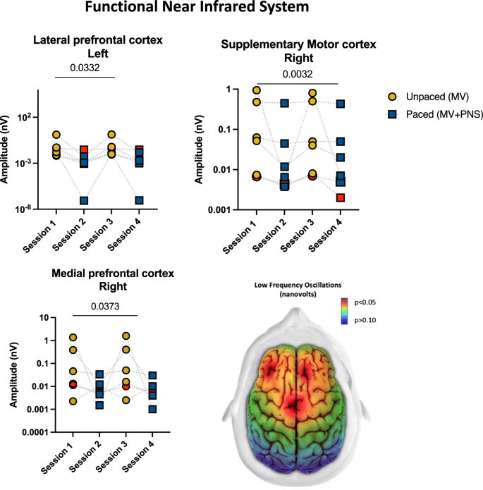 Fig. 3: Phrenic nerve changes the cerebral vessel tonus in deeply sedated mechanically ventilated patients.