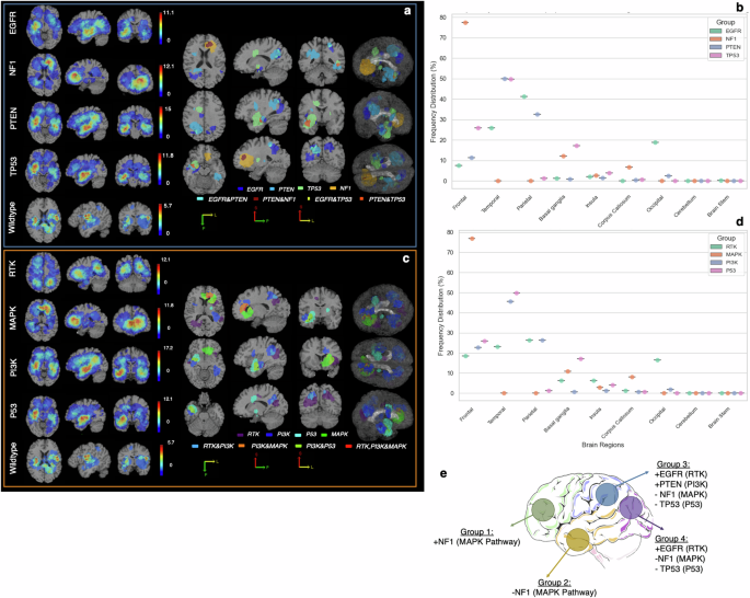 Fig. 2: Spatiogenomic landscape of IDH-wildtype GBM.