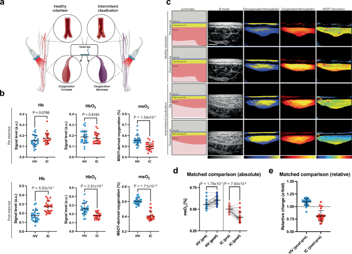 Fig. 2: MSOT imaging results before and after the heel raise exercise.