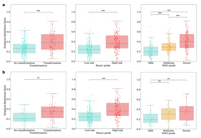 Fig. 3: The distribution of dysplasia-epithelium ratios across OED cases based on transformation and grade.