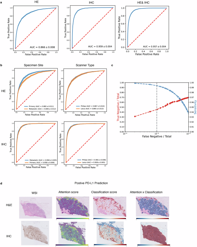 Evaluating biomarker prediction for PD-L1 status in BRCA.