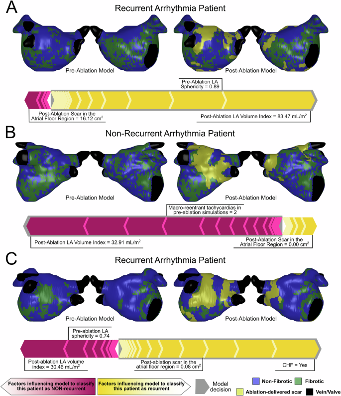 Fig. 5: Explanation of individual patient prediction scores for representative patients in the original dataset.