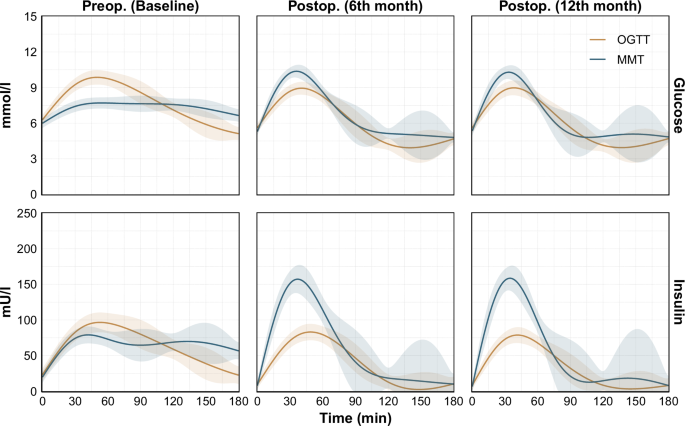 Fig. 3: Comparison of average preoperative (Preop.) and postoperative (Postop.) responses in oral glucose tolerance test (OGTT) vs. mixed meal test (MMT).