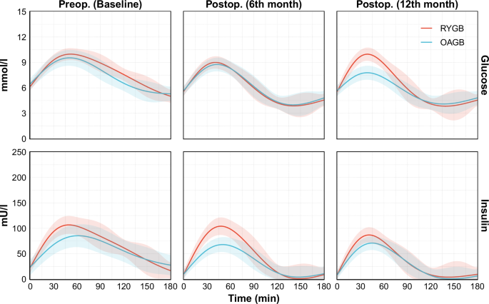 Fig. 4: Oral glucose tolerance test (OGTT) responses by bariatric surgery type.