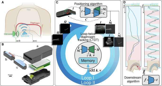 Fig. 1: Overview of the multi-view ultrasound system for diaphragm monitoring.