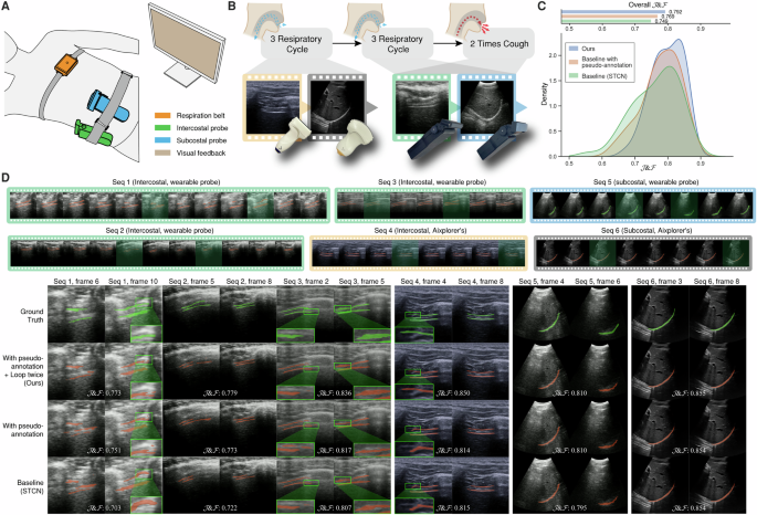 Fig. 2: Experimental setup and ablation studies on LTDT.