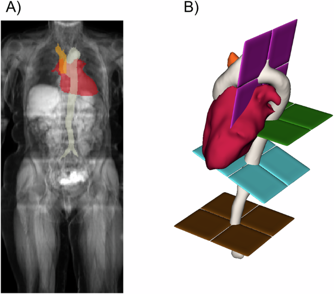 Fig. 1: Segmentation of abdominal vascular structures from MRI.