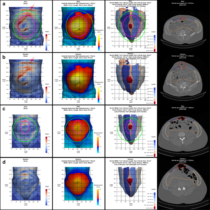 Fig. 1: HEDI results for two patients.