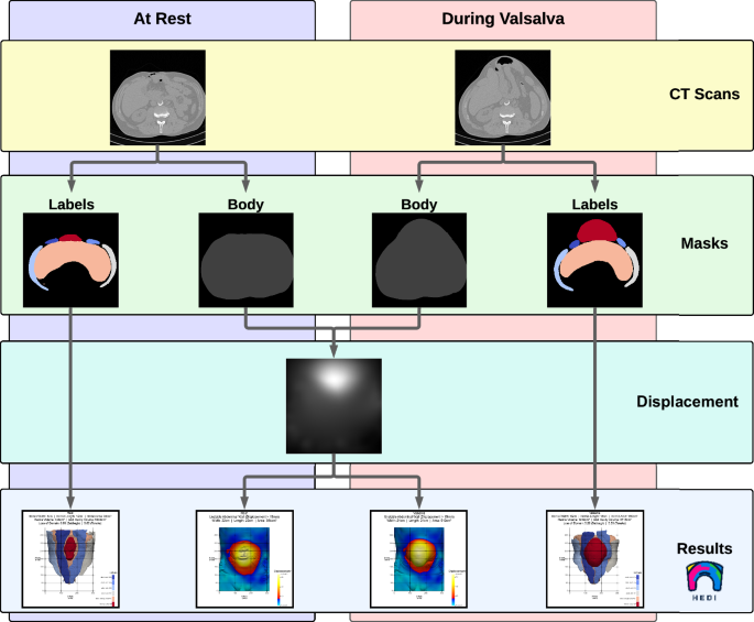 Fig. 4: Flow chart of the HEDI workflow.