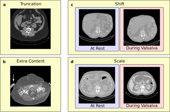 Fig. 5: Examples of inapplicable CT scans.