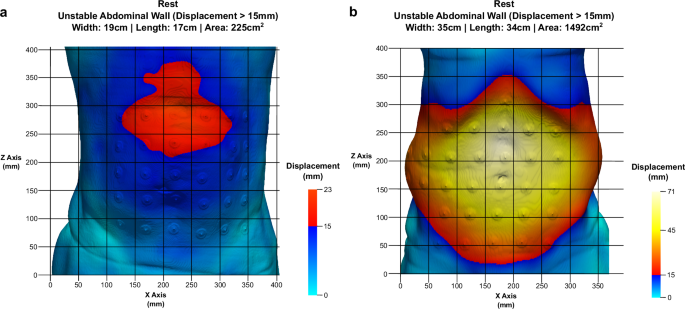 Fig. 6: HEDI results illustrating electrode use for evaluating the registration process.