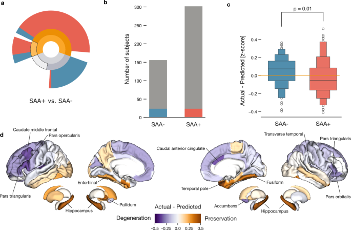 Fig. 5: Aggregated alpha-synuclein proteins associated with increased brain atrophy.