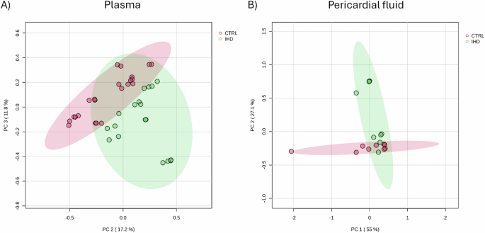 Fig. 2: Principal component analysis, PCA, applied to the data buckets of 1H CPMG NMR spectra obtained from plasma and pericardial fluid samples.