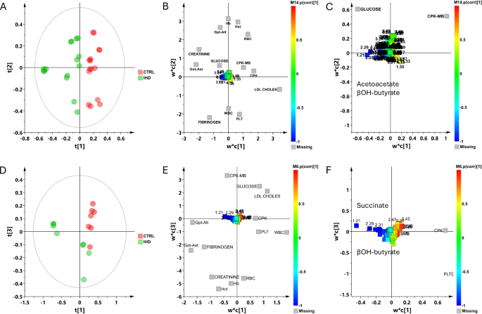 Fig. 5: Partial Least Square (PLS) regression model for plasma (n = 20, in technical duplicate) and pericardial fluid (n = 10, in technical duplicate) of patients affected from IHD in comparison with non affected (CTRL).