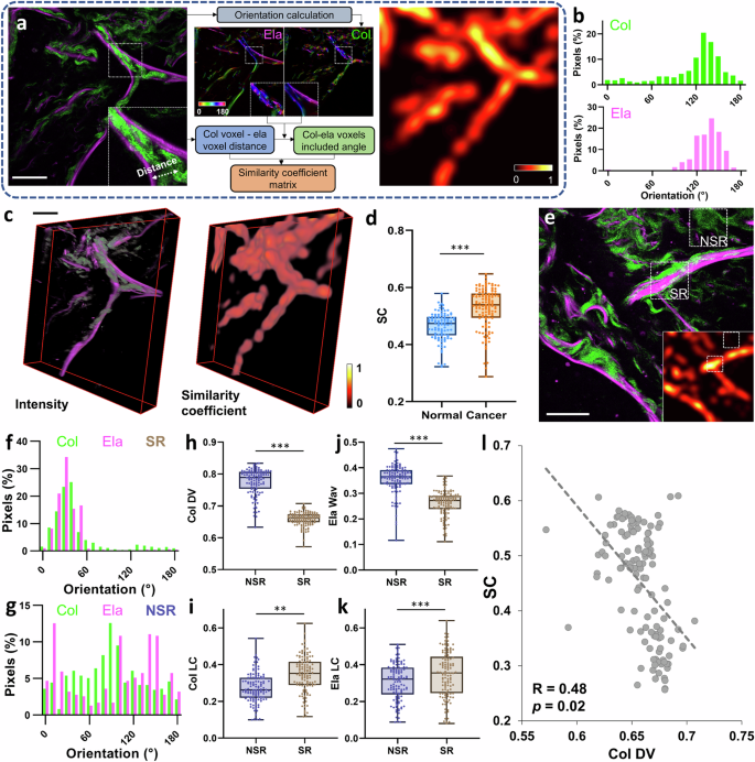 Fig. 2: 3D similarity coefficient (SC) evaluation of collagen and elastin fibers in lung tissues.