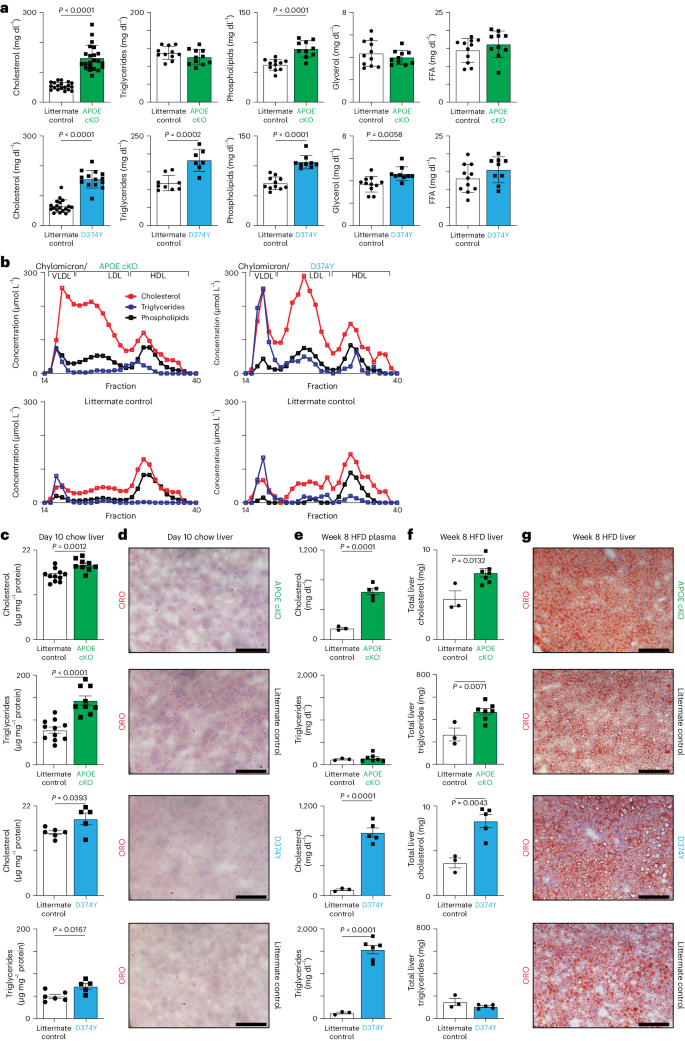 肝臓の免疫系が「悪玉コレステロール」を食べる(The liver immune system eats up ‘bad cholesterol’)