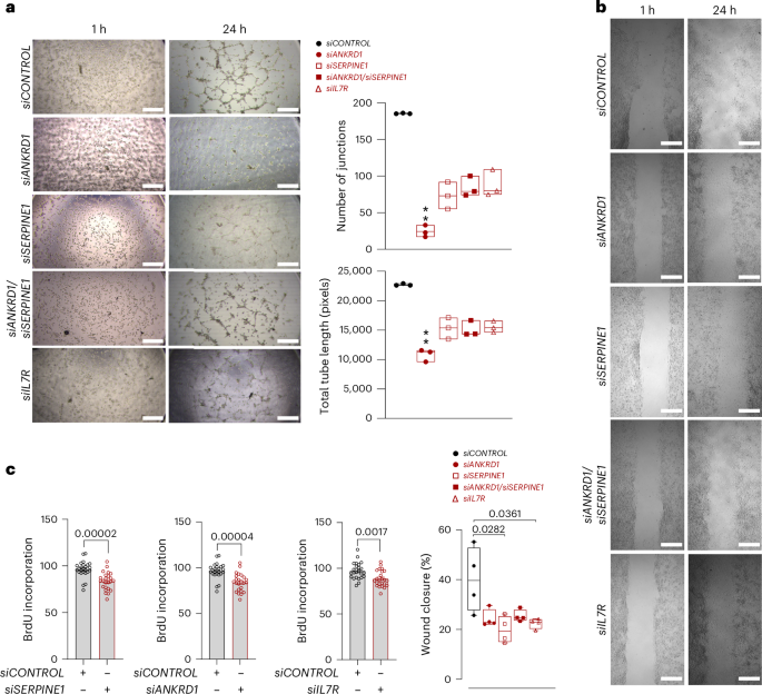 Fig. 7: Inhibition of SERPINE1, IL7R and ANKRD1 in HCFs and HCMECs.