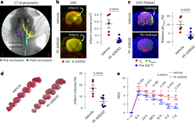 Fig. 4: MRI of vascular disruption in rabbit stroke model confirms protective effects of SKI-1 inhibitor PF-429242.