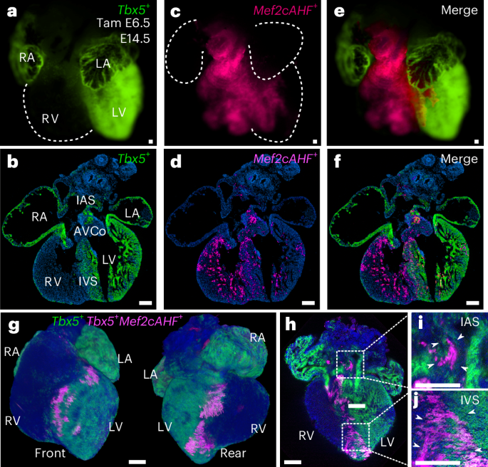 Fig. 1: Tbx5+/Mef2cAHF+ lineage marks a compartment boundary at the cardiac IVS.