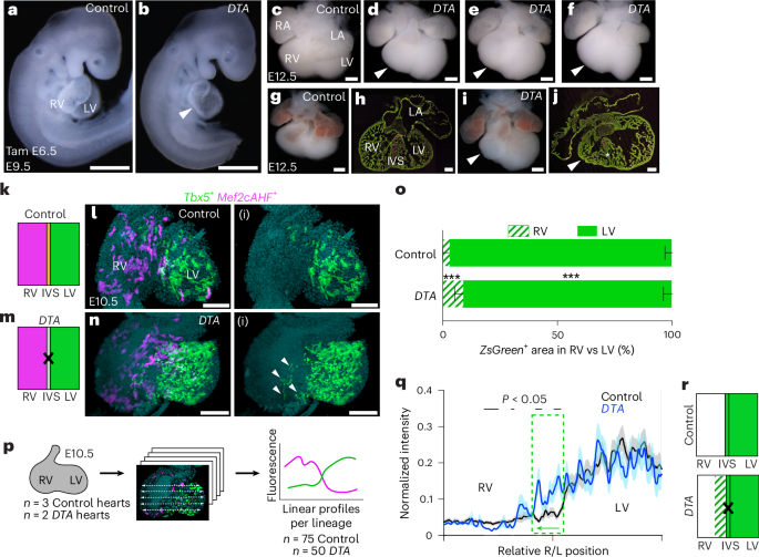Fig. 3: Cell ablation of Tbx5+/Mef2cAHF+ progenitors causes RV hypoplasia, IVS disorganization and lineage mixing.