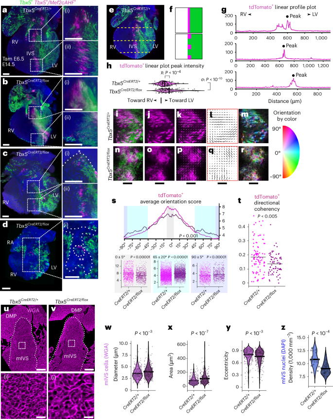 Fig. 4: Reduced TBX5 dosage caused VSDs, perturbations to IVS boundary position and integrity, and abnormal IVS cell arrangement.
