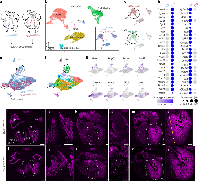 Fig. 5: Slit2 and Ntn1 are Tbx5-sensitive genes in the IVS.