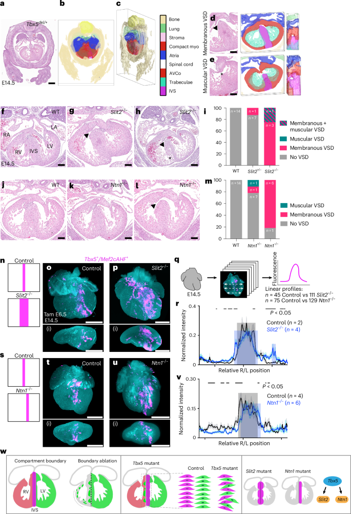 Fig. 6: Slit2 and Ntn1 are essential for proper ventricular septation and compartment boundary regulation.