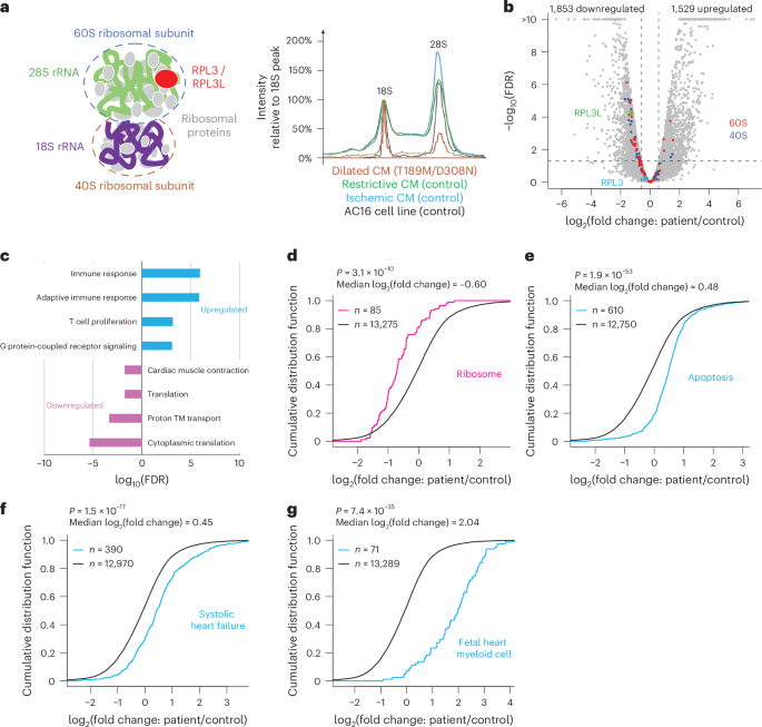 Fig. 2: Ribosome defects in explanted patient hearts.