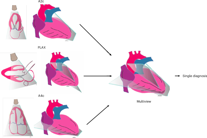 Fig. 1: Integrating multiple 2D tomographic images of a 3D structure.