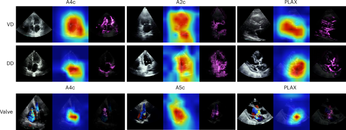 Fig. 4: Grad-CAM and guided grad-CAM AI explainability applied to DNNs for three echo tasks.