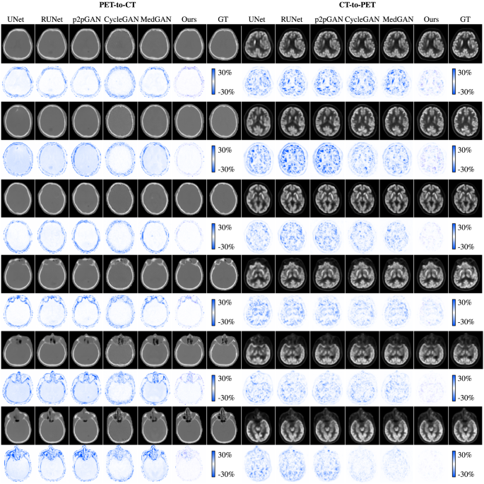 Fig. 3: Visual comparison of synthesized positron emission tomography (PET) and computed tomography (CT) images for six typical cases by different methods.