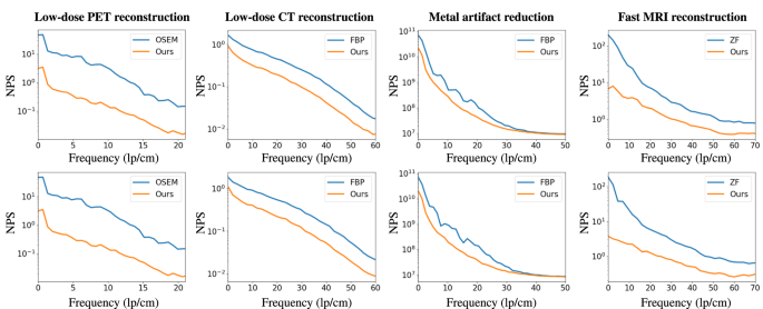 Fig. 4: The noise power spectrum analysis (NPS) for different reconstruction tasks.
