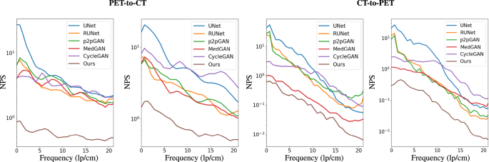 Fig. 5: The noise power spectrum (NPS) analysis of the synthesized images by different state-of-the-art methods.