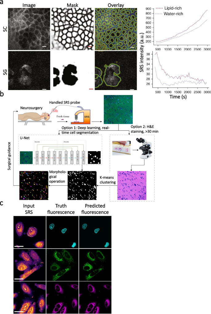 Machine learning empowered coherent Raman imaging and analysis for ...
