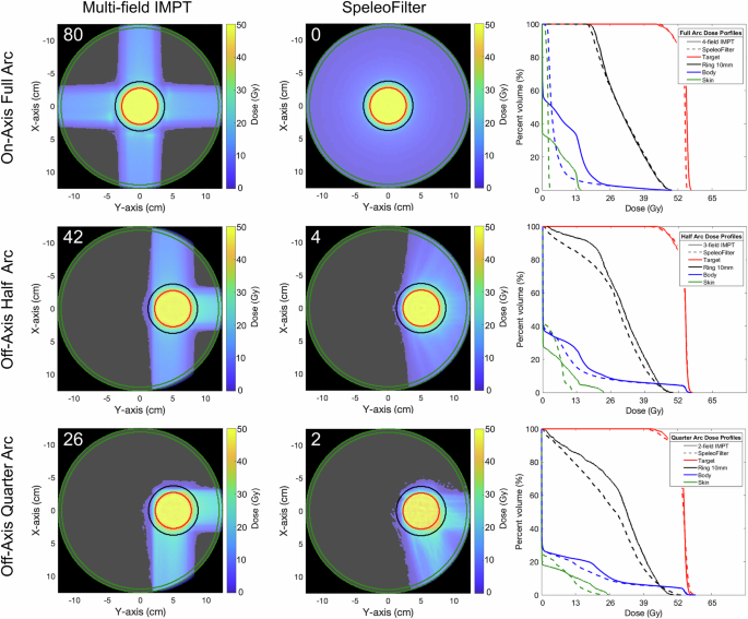 Fig. 6: Dose profiles of the full and partial arc treatments delivered with a 5 cm SpeleoFilter (center row) compared against multifield IMPT treatments (left row).
