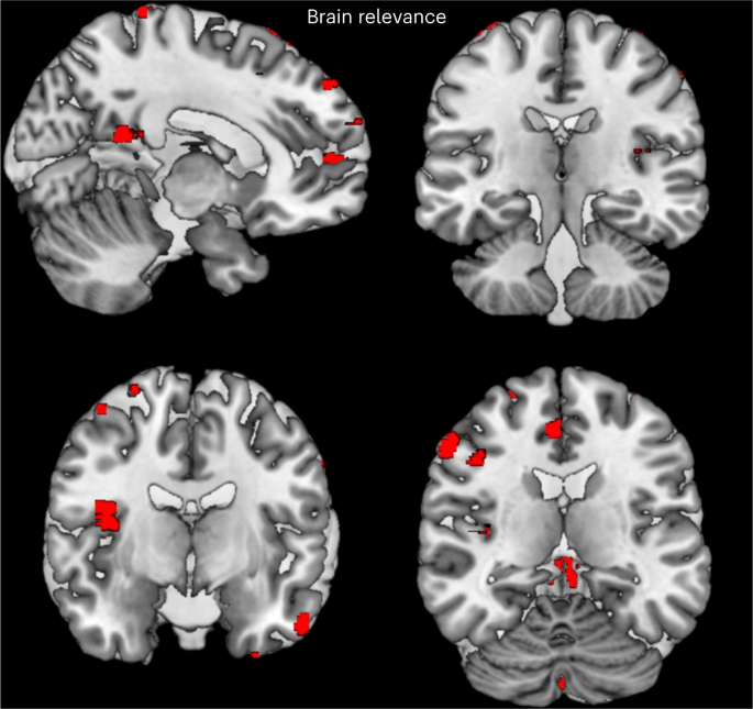 Fig. 1: Voxels with the red color contribute more to the classification decision.