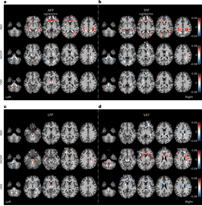 Regional adiposity shapes brain and cognition in adults | Nature Mental ...
