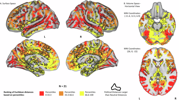 Fig. 3: Differences in neural response between the two scans.