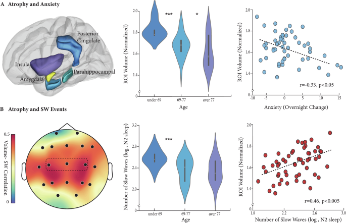 Impaired slow-wave sleep accounts for brain aging-related increases in  anxiety | Communications Psychology