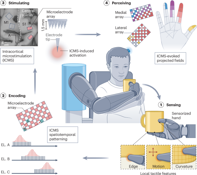 Cortical somatosensory feedback for brain-controlled bionic hands ...