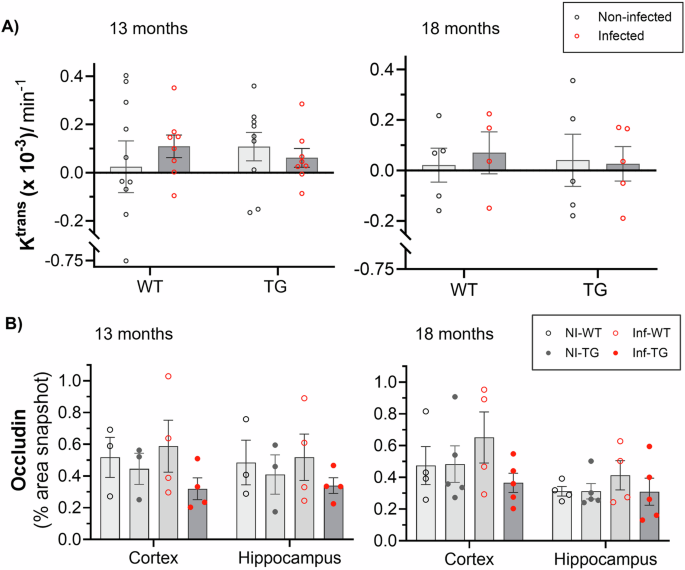 MRI detects blood-brain barrier alterations in a rat model of Alzheimer’s disease and lung infection