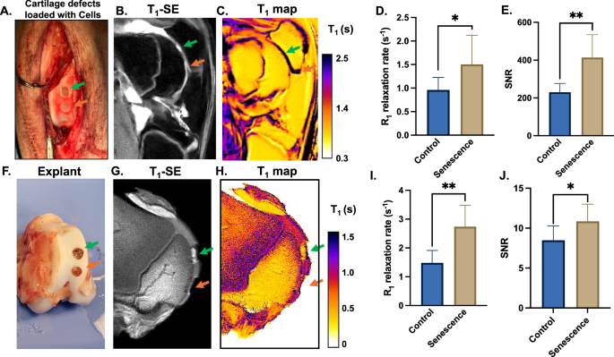 Fig. 4: Detection of senescent cells with the β-gal responsive Gd-chelate and MRI.