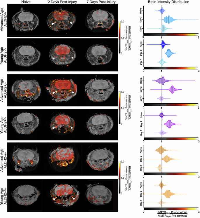 Fig. 4: Mapping of brain aldehydes by ProxyNA3 in a mouse model of mTBI.